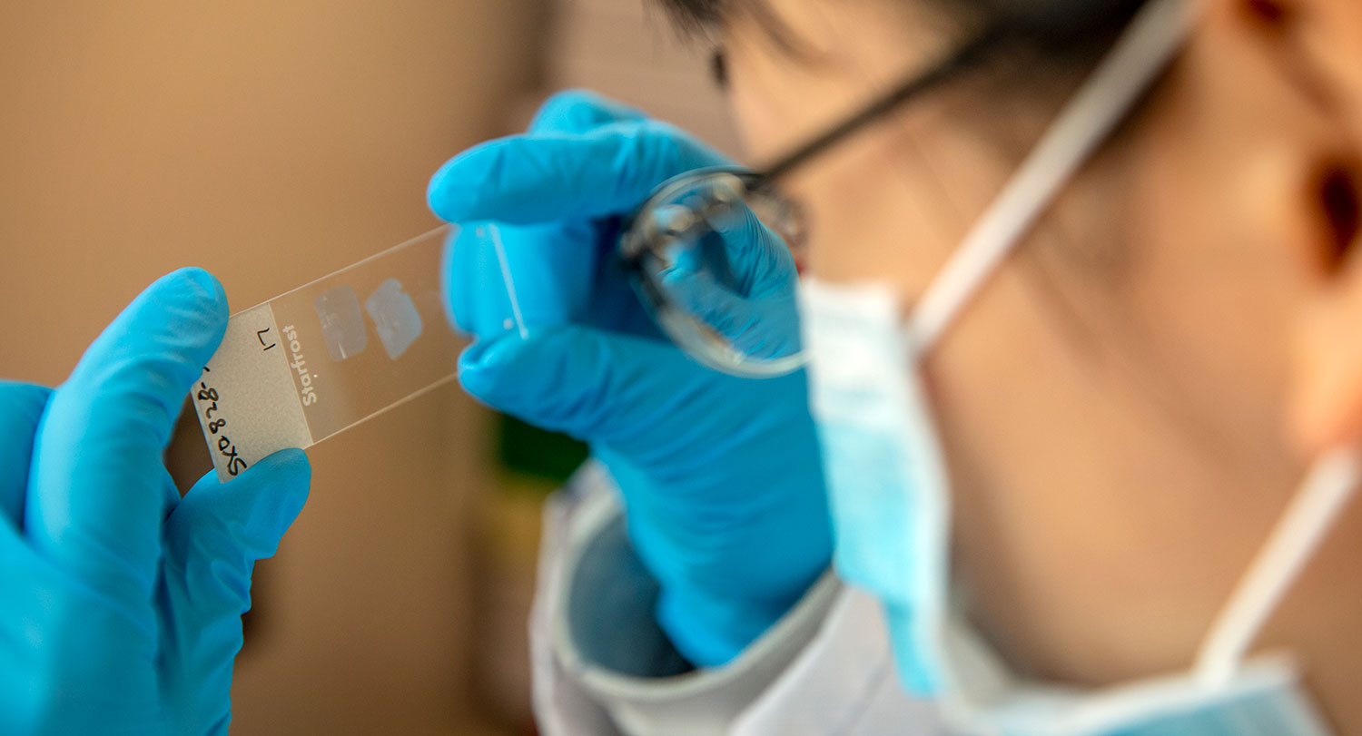 Researcher holding a microscope slide.